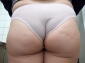 150
